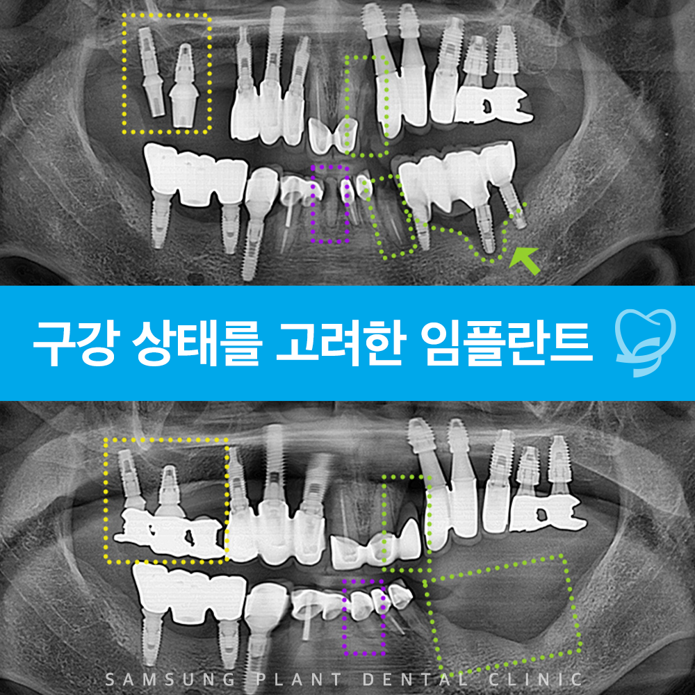 신정네거리역치과