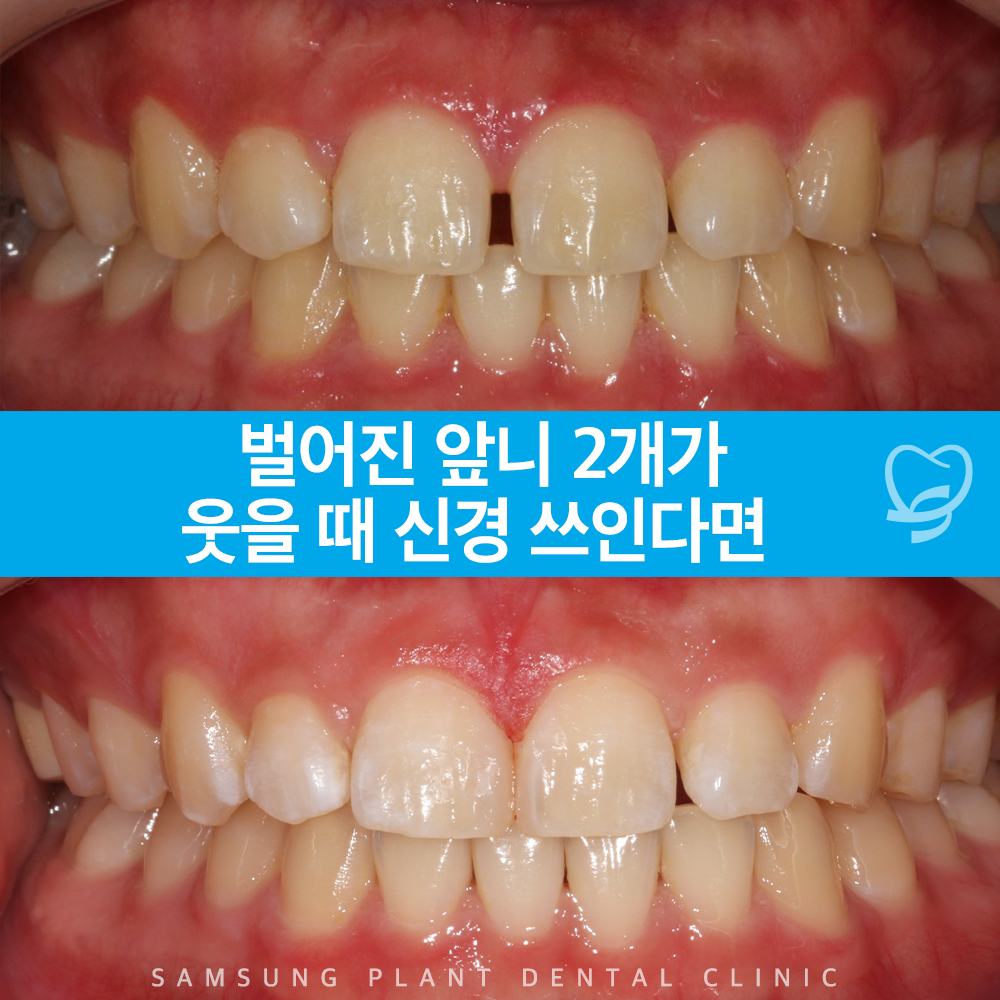 신정네거리치과