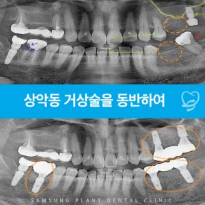 목동임플란트치과