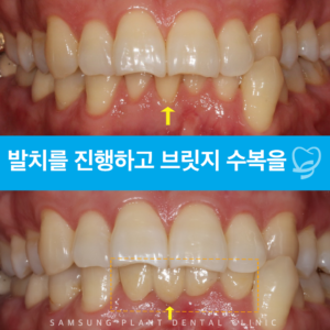 신정동보철치료