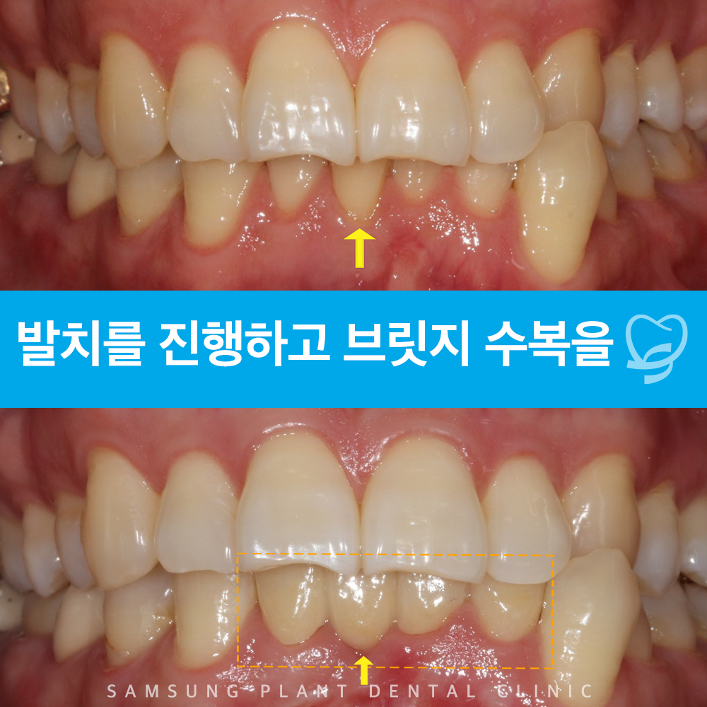 신정네거리역치과