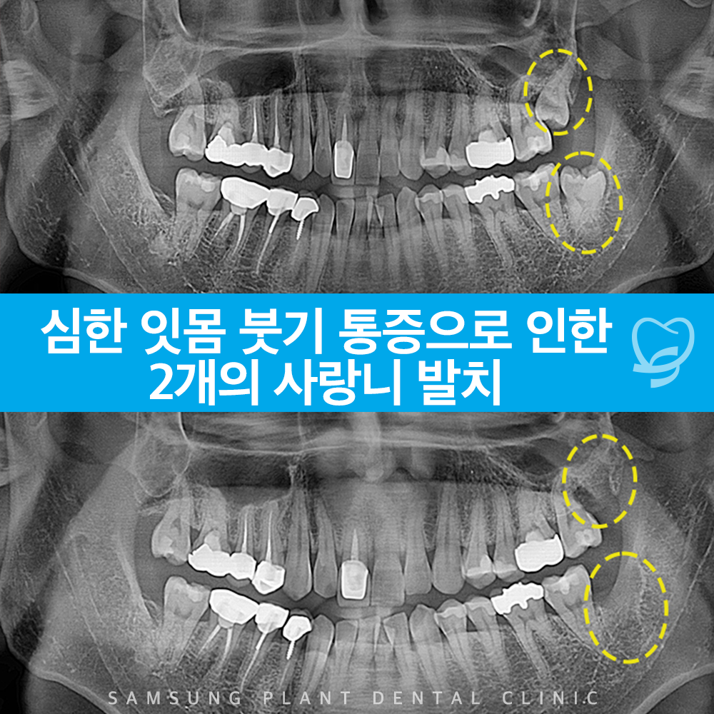 신정네거리역치과