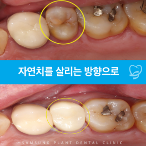목동신경치료