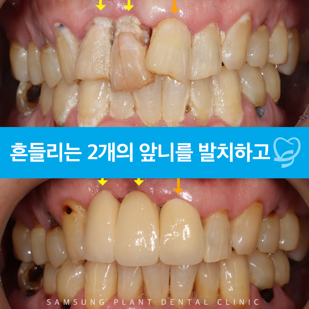 신정네거리역치과