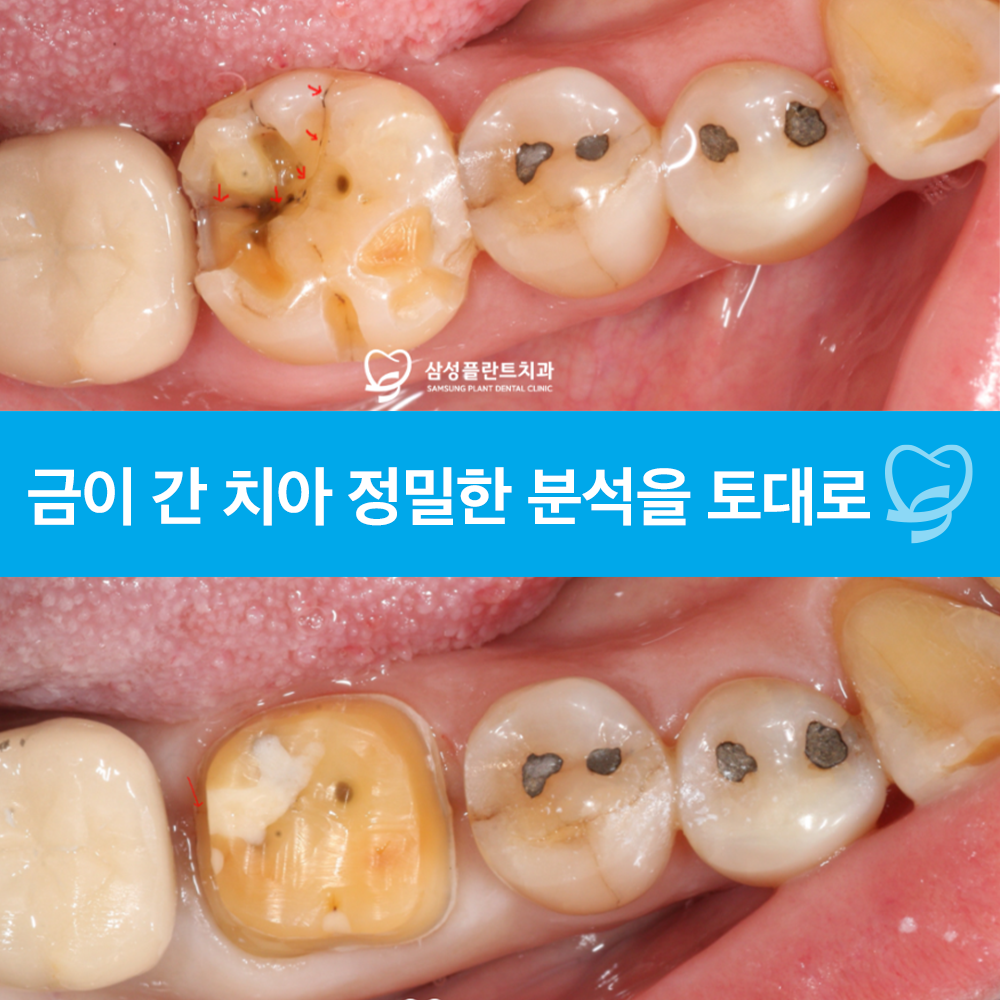 양천구치과