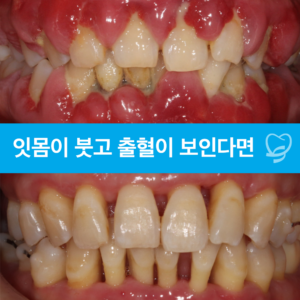 신정네거리역치과