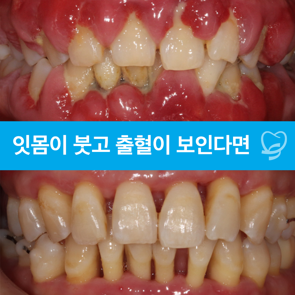 신정네거리역치과