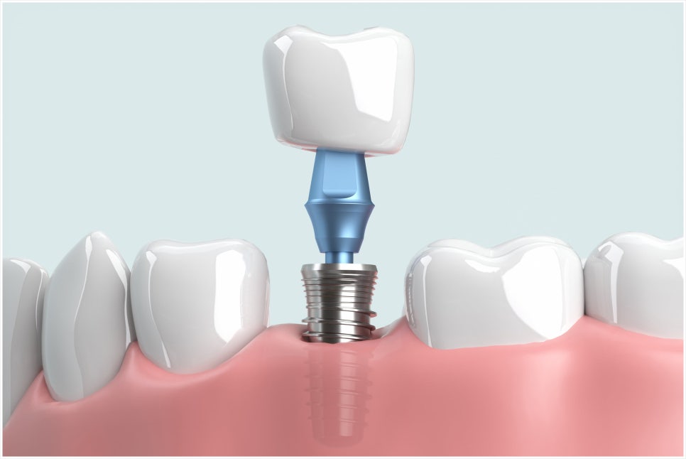 신정네거리역치과