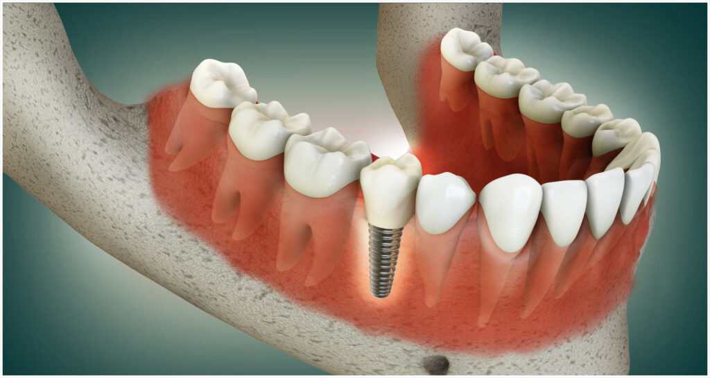 신정네거리역치과