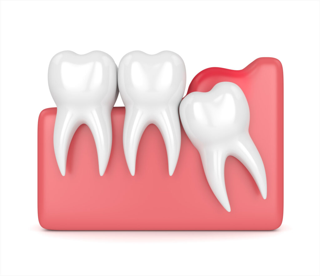신정네거리역치과