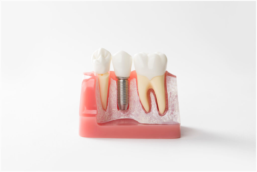 신정네거리역치과