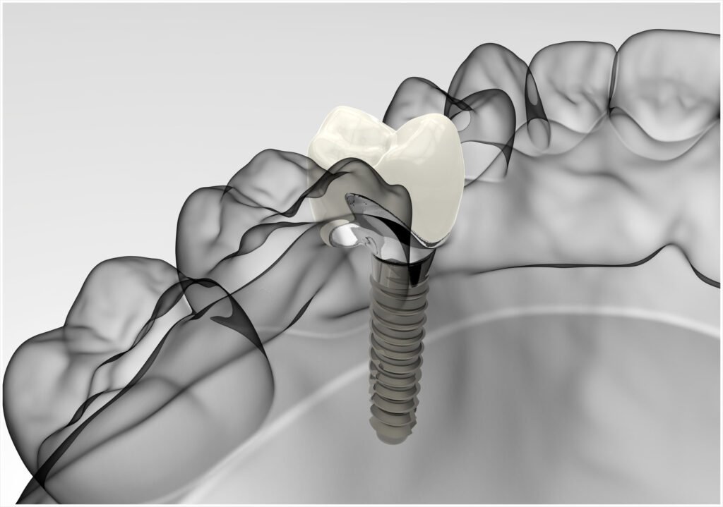 신정네거리역치과