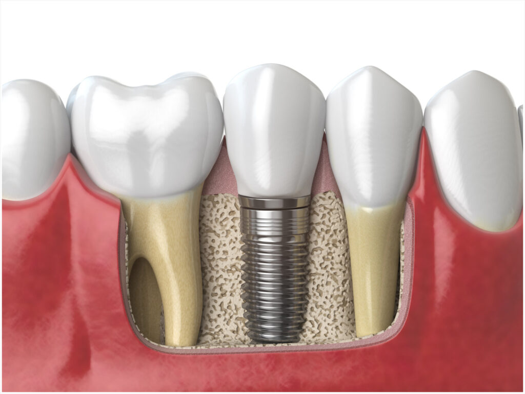 신정네거리역치과