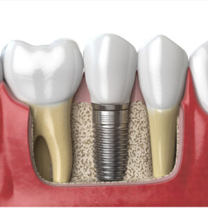 신정네거리역치과