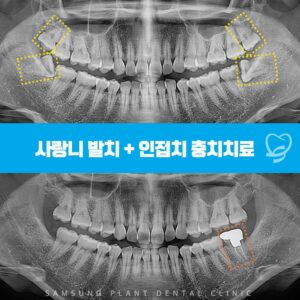 신정네거리역치과