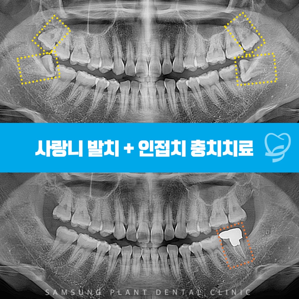 신정네거리역치과