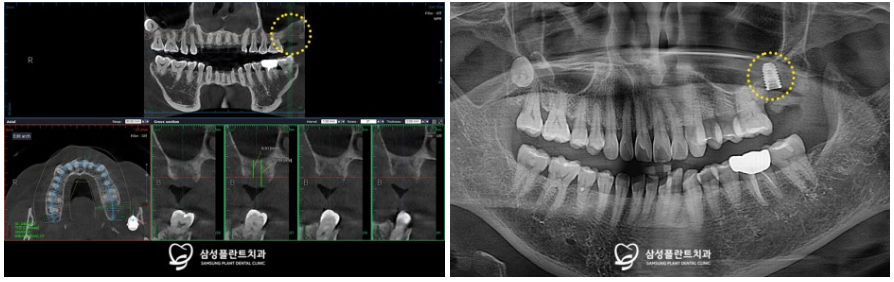 신정네거리치과