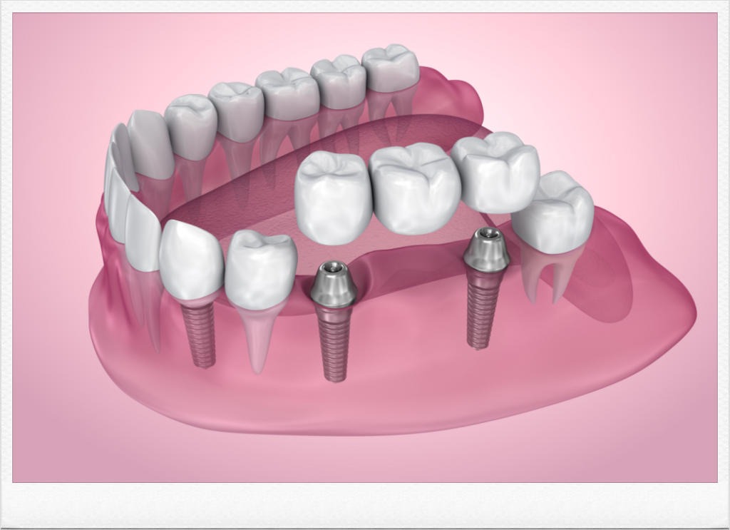 신정네거리역치과