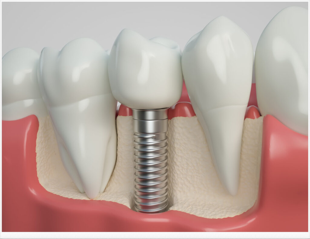 신정네거리역치과
