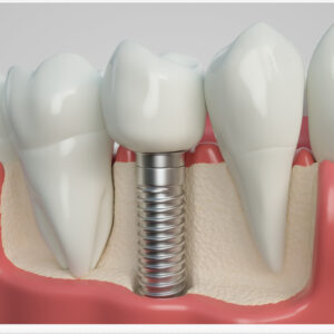 신정네거리역치과