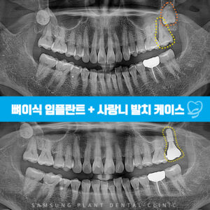 신정네거리치과