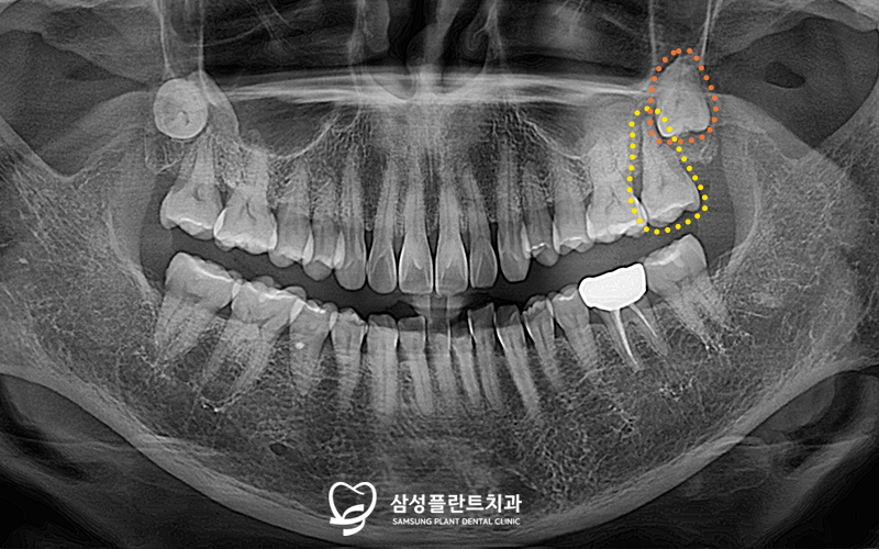 신정네거리치과