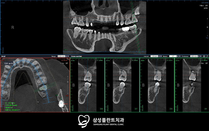 신정네거리치과