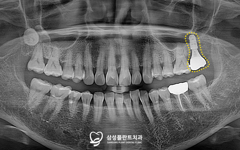 신정네거리치과