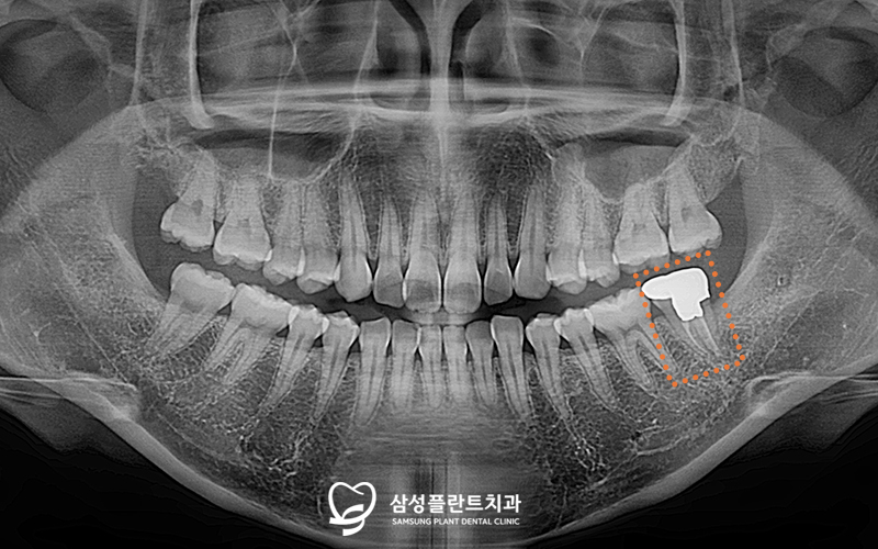 신정네거리역치과