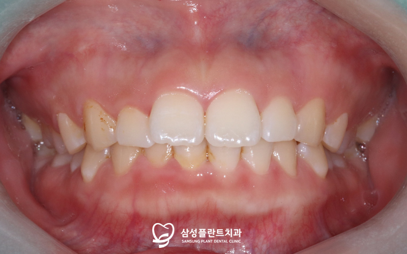 신정네거리역치과