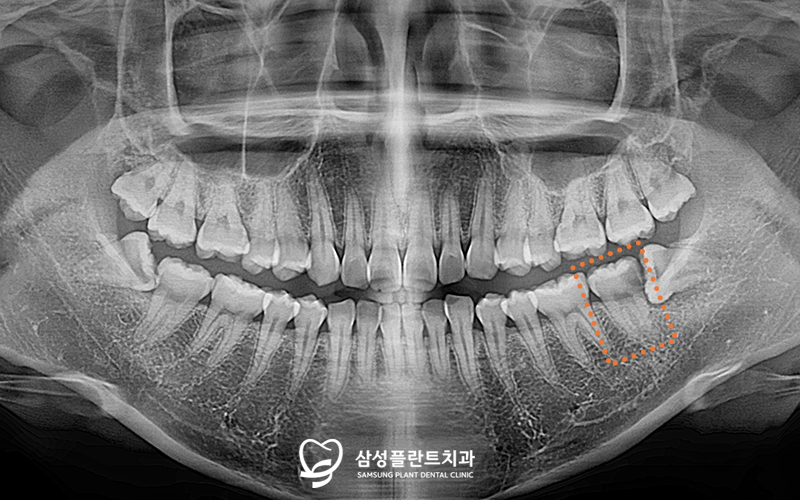 신정네거리역치과