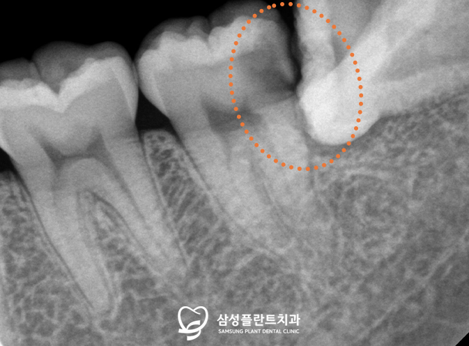 신정네거리역치과