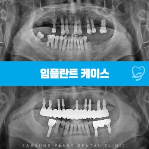 신정네거리역치과