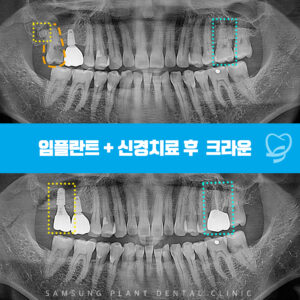 신정네거리역치과