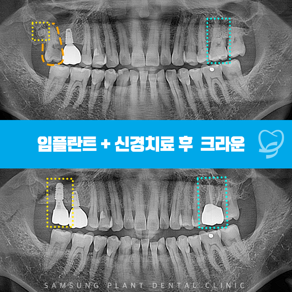신정네거리역치과