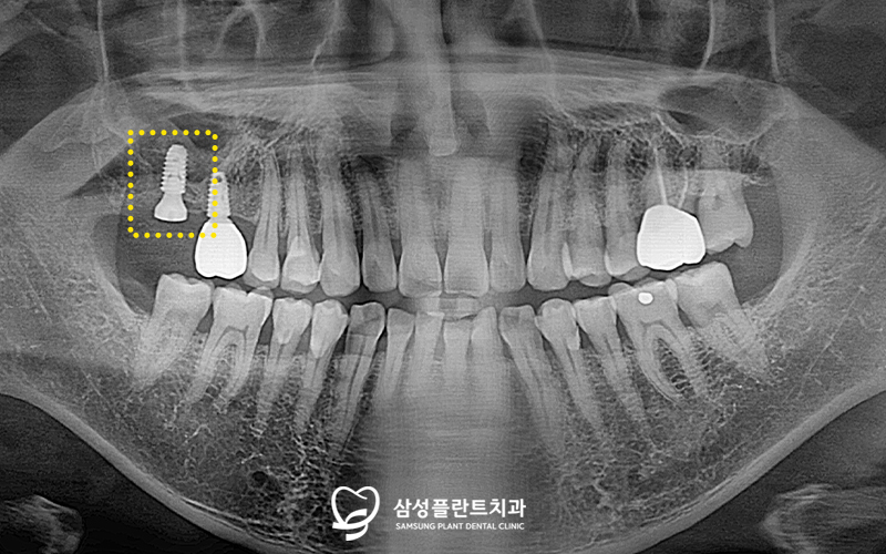 신정네거리역치과