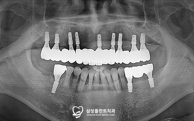 신정네거리역치과