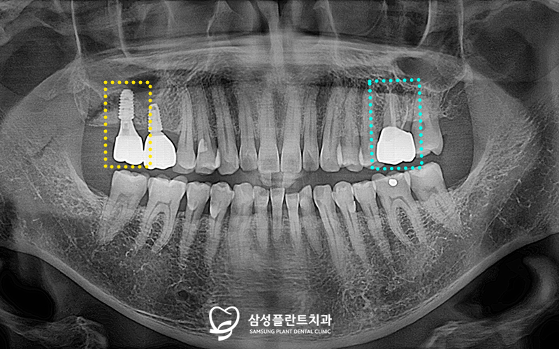 신정네거리역치과