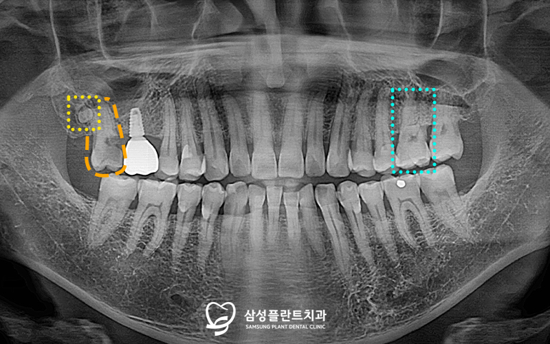 신정네거리역치과