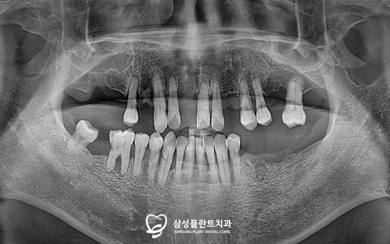 신정네거리역치과