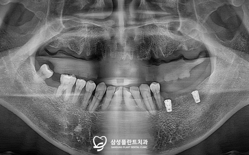 신정네거리역치과