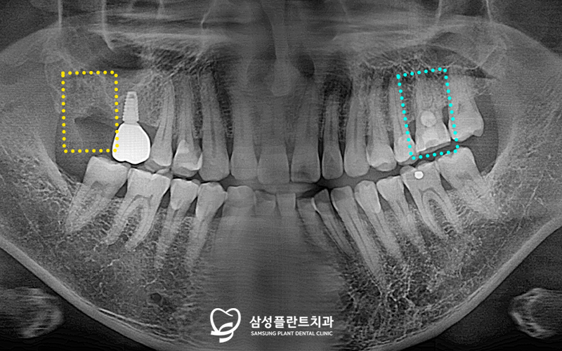 신정네거리역치과
