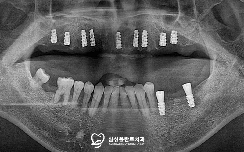 신정네거리역치과