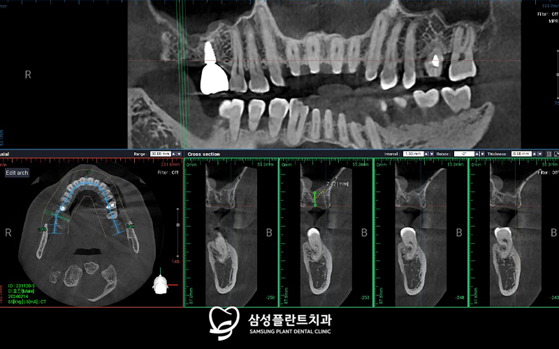 신정네거리역치과