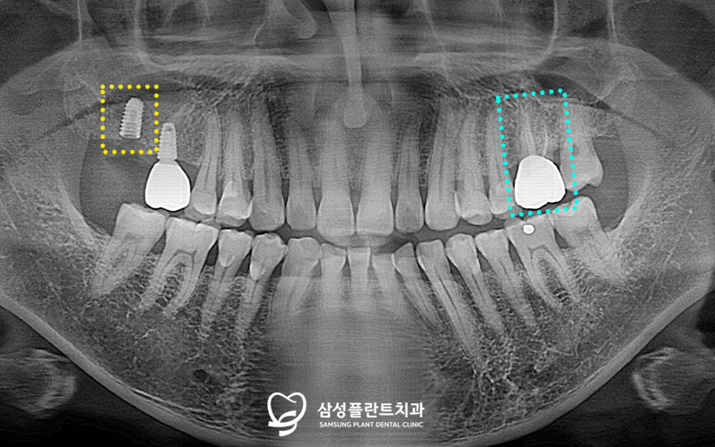 신정네거리역치과