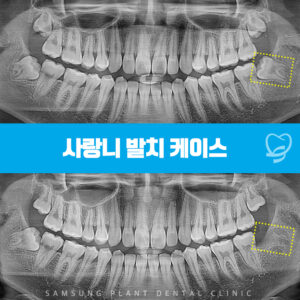 신정동치과