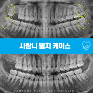 신정네거리역치과