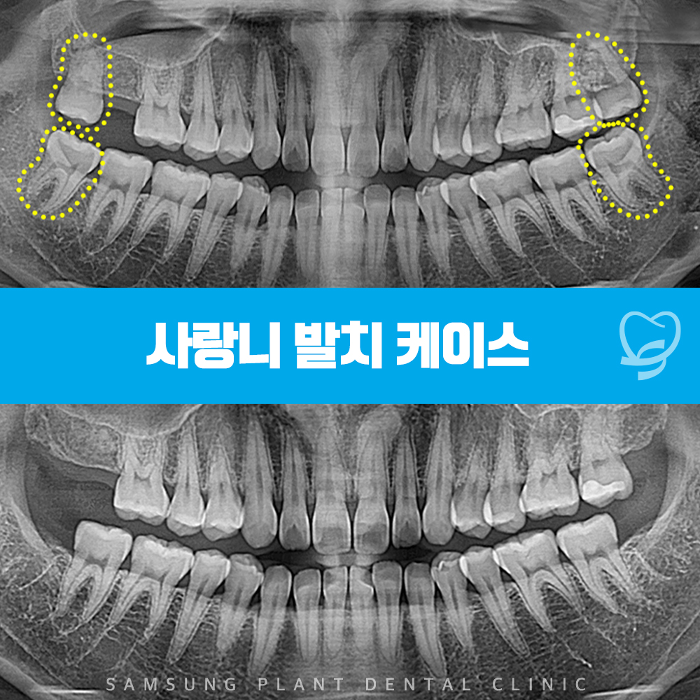 신정네거리역치과