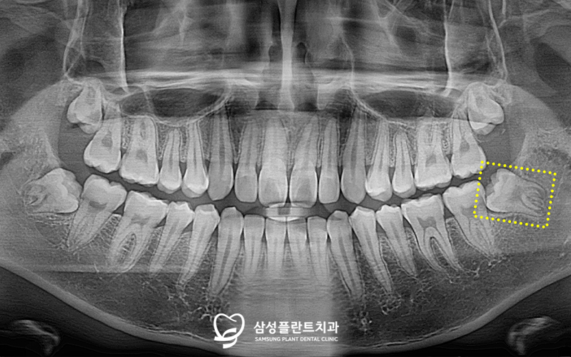 신정동치과