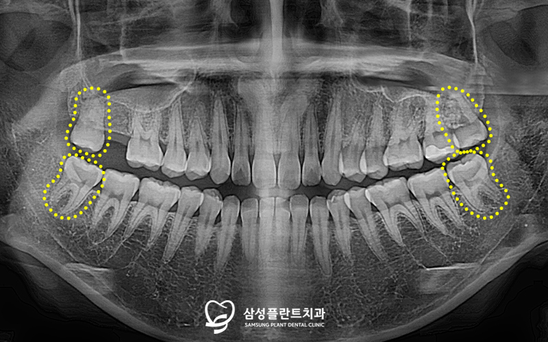 신정네거리역치과